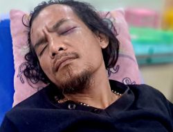 Jurnalis Ambarita Alami Kekerasan di Tambun Selatan, Berakibat Mata Kirinya Buta