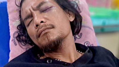 Jurnalis Ambarita Alami Kekerasan di Tambun Selatan, Berakibat Mata Kirinya Buta