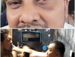 Pria di Cipondoh Diduga Dipukul Tetangga, Korban Mengaku Alami Lebam di Mata