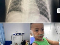 Warga Cengkareng Resah, Pembakaran Sampah Diduga Tiap Hari Picu Gangguan Kesehatan Anak